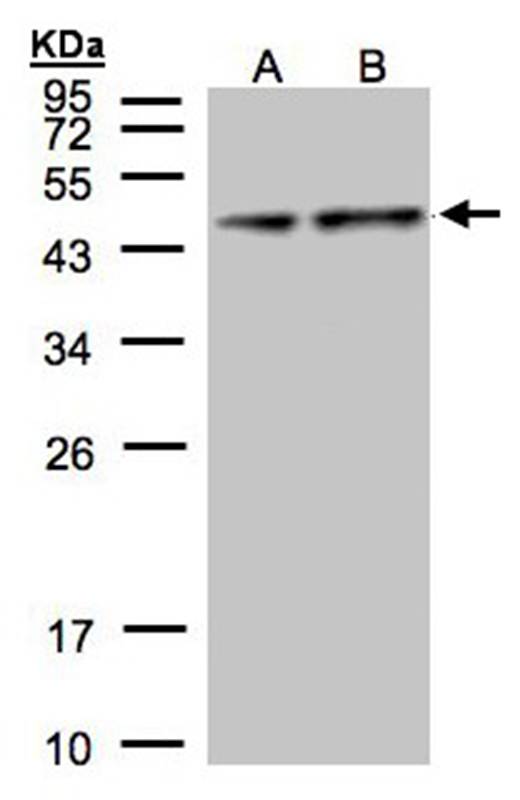 Pyruvate Dehydrogenase E1 alpha antibody