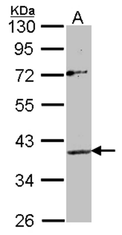 Apelin receptor antibody