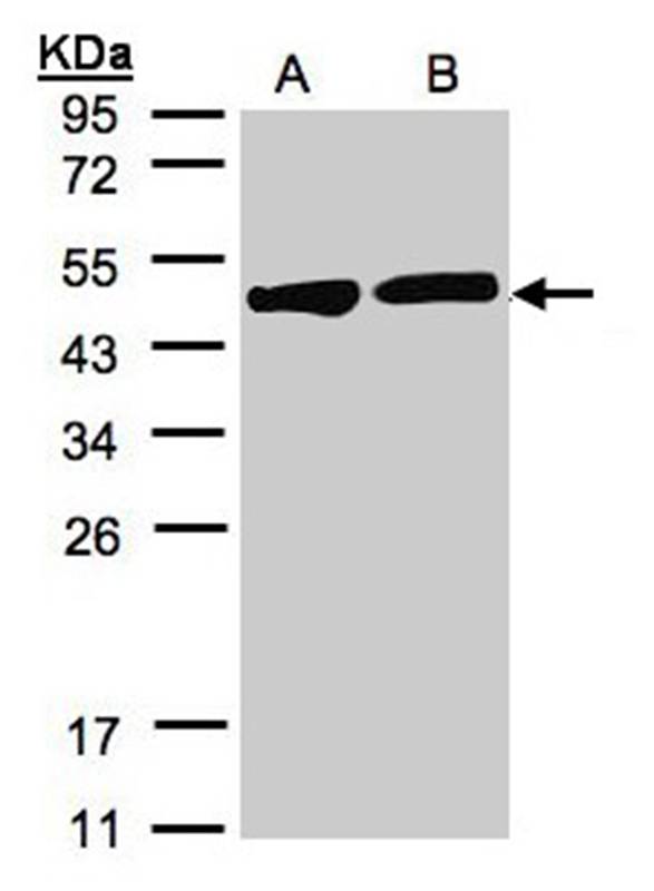 Creatine Kinase BB antibody