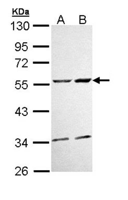 CaMKII delta antibody