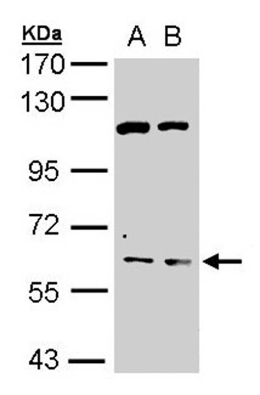 AChE antibody