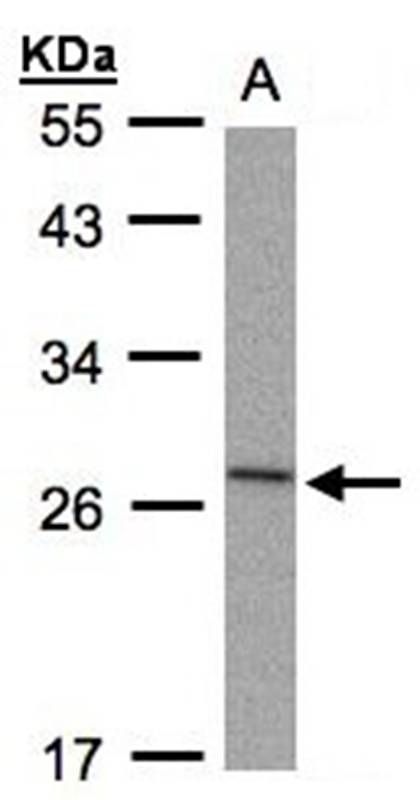ILra antibody