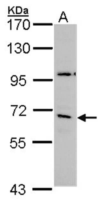 GAD65 antibody