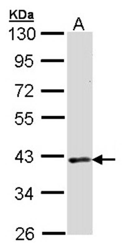 DMC1 antibody