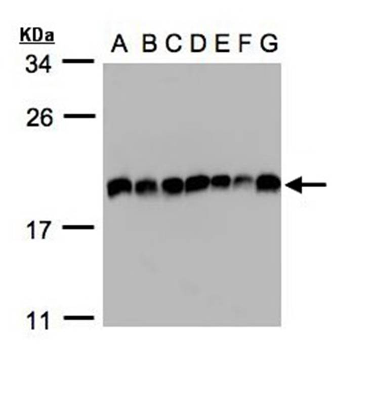 EIF5A2 antibody