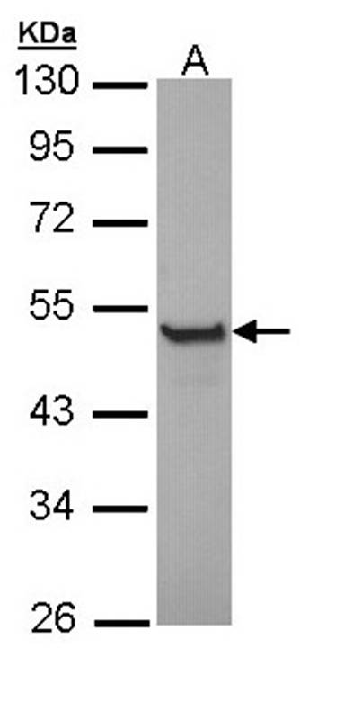 Cytokeratin 13 antibody