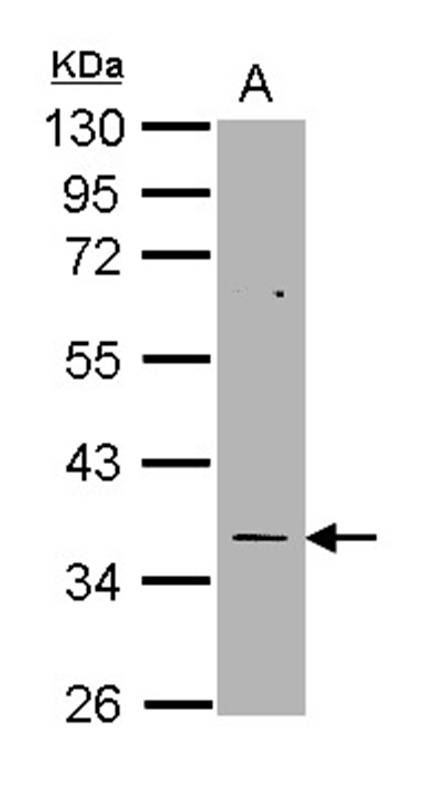 TS antibody