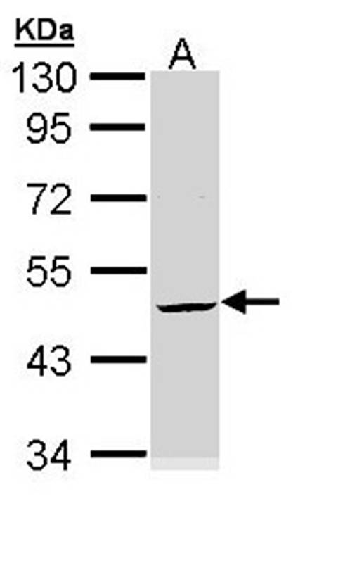 Cytokeratin 20 antibody