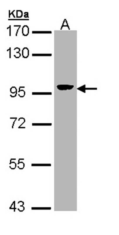 Villin antibody