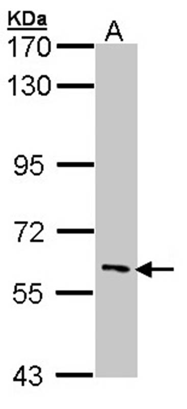 IRAK3 antibody