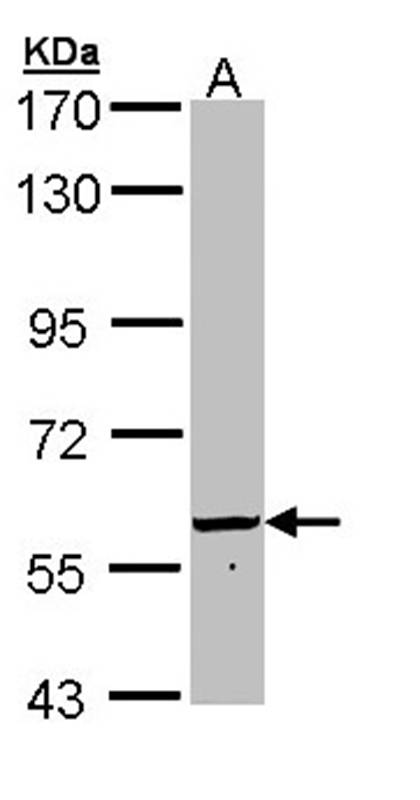 FTCD antibody
