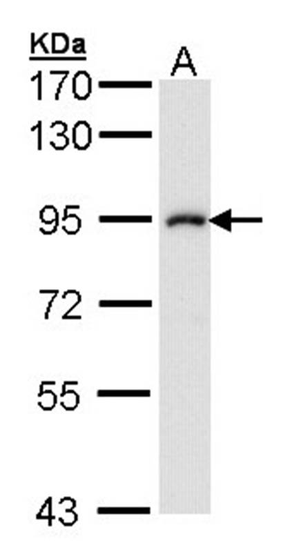 IKK beta antibody