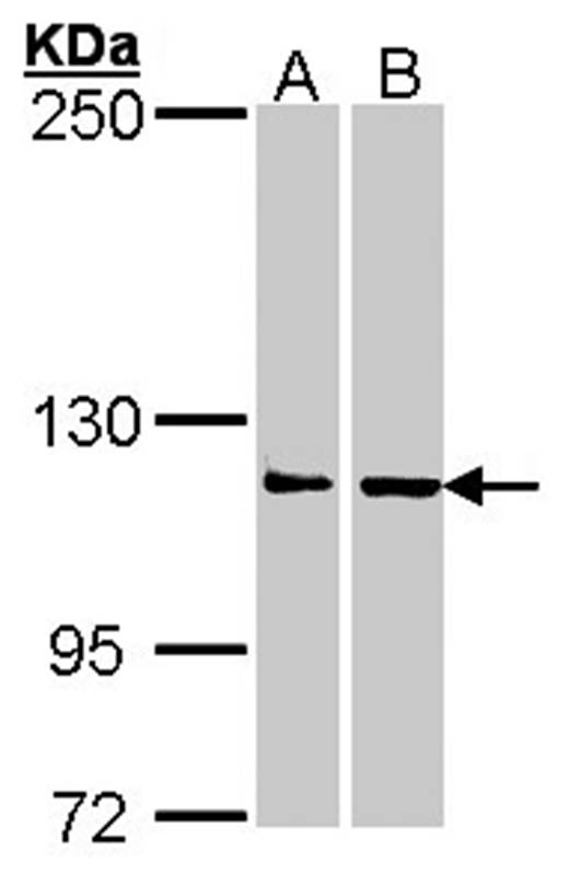 Adenosine Deaminase antibody