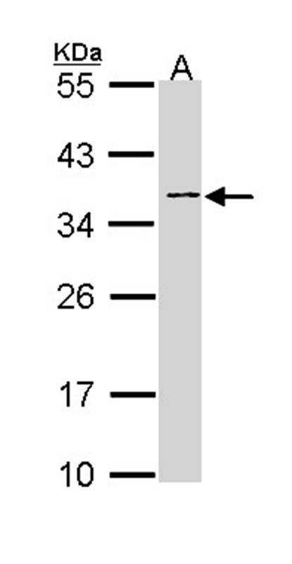 NAGAT antibody