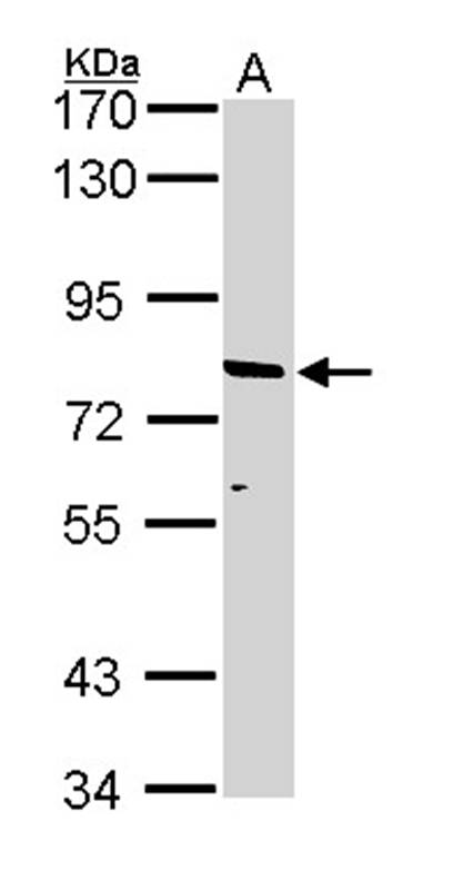 ABCD2 antibody
