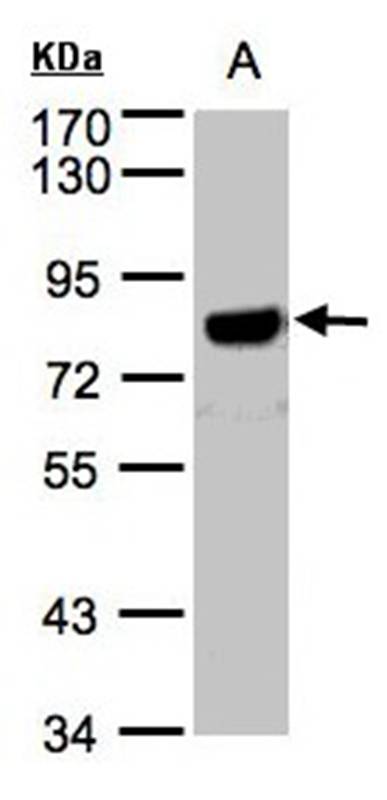 beta-Amyloid antibody