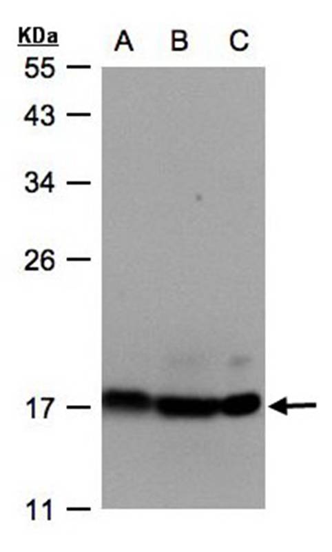 ATP synthase H+ transporting mitochondrial F1 complex delta subunit precursor antibody