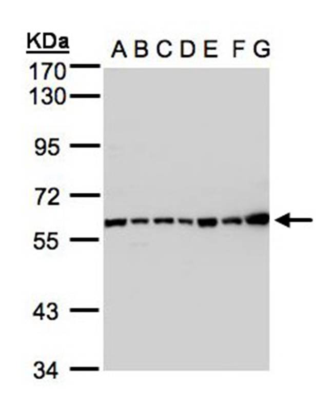 Complement C2 antibody