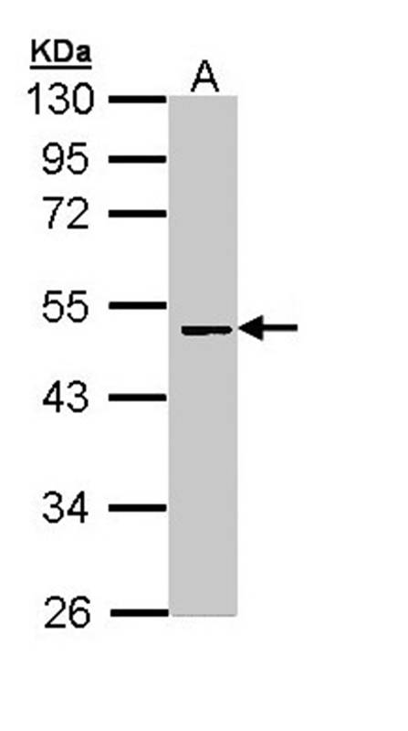 Factor X antibody