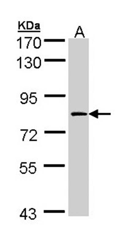 Factor XIIIa antibody