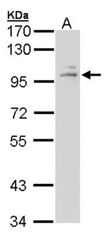 GR antibody