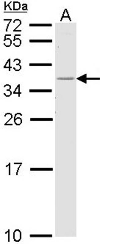 HLA-DR antibody