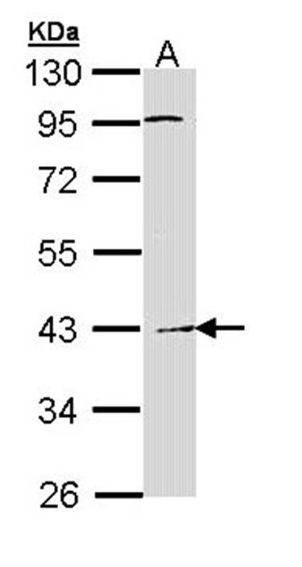 Haptoglobin antibody
