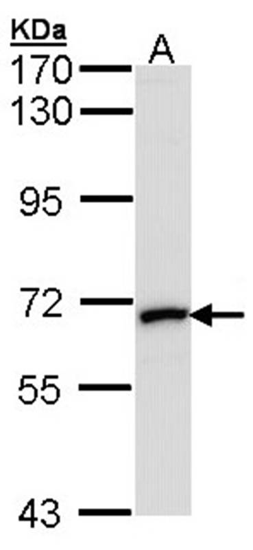 MMP2 antibody