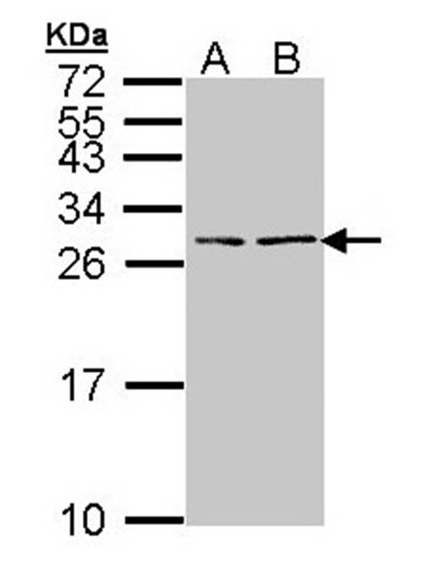 BNP antibody