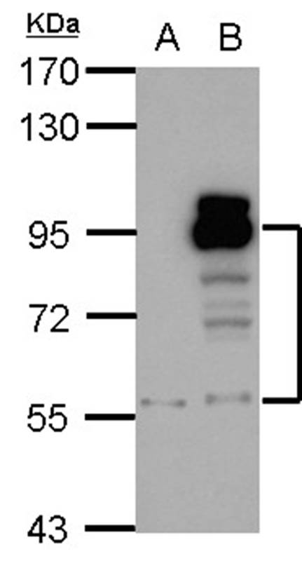 PDE4D antibody