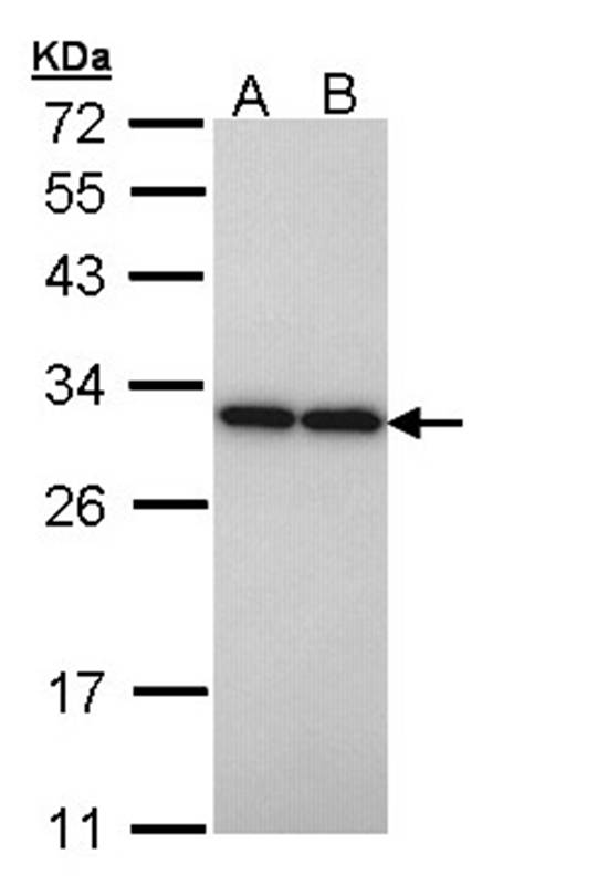 PGAM2 antibody