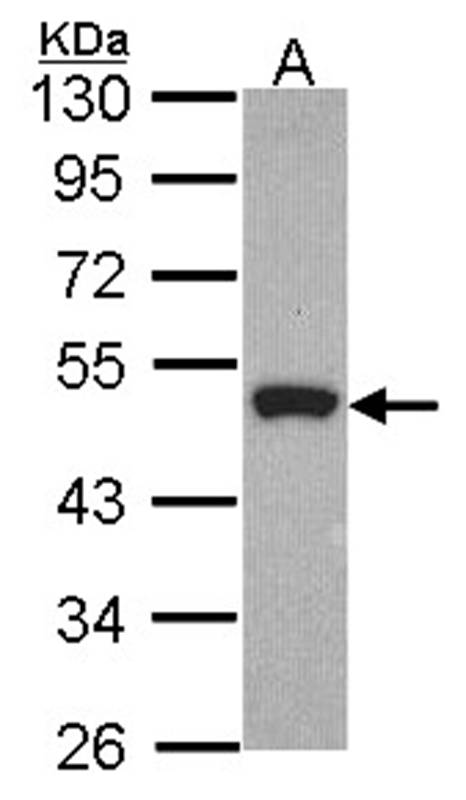 Peripherin antibody