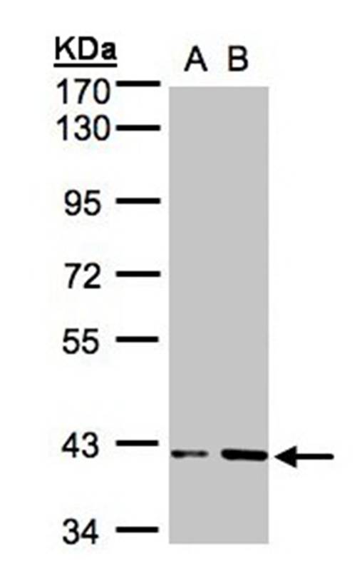 PRPP synthetase-associated protein 1 antibody