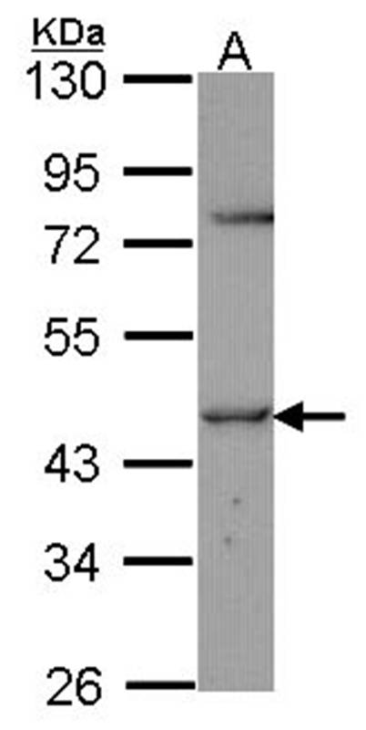 TR Alpha antibody