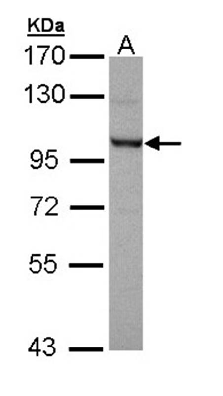 oral-facial-digital syndrome 1 antibody