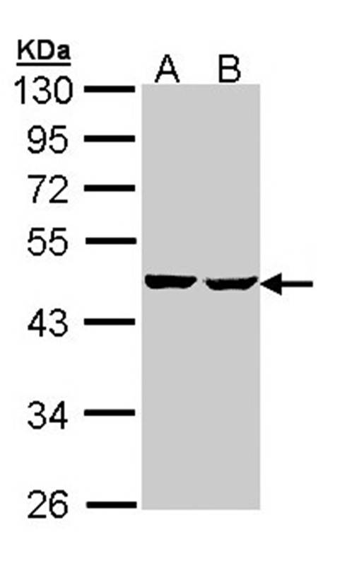 succinate-CoA ligase, ADP-forming, beta subunit precursor antibody