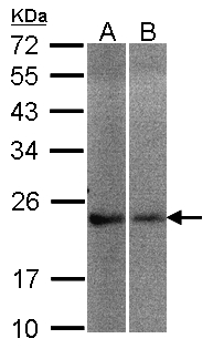 NCS antibody