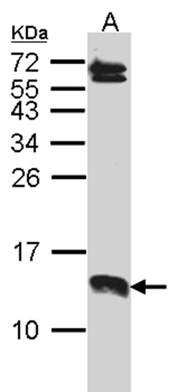 stress-associated endoplasmic reticulum protein 1 antibody