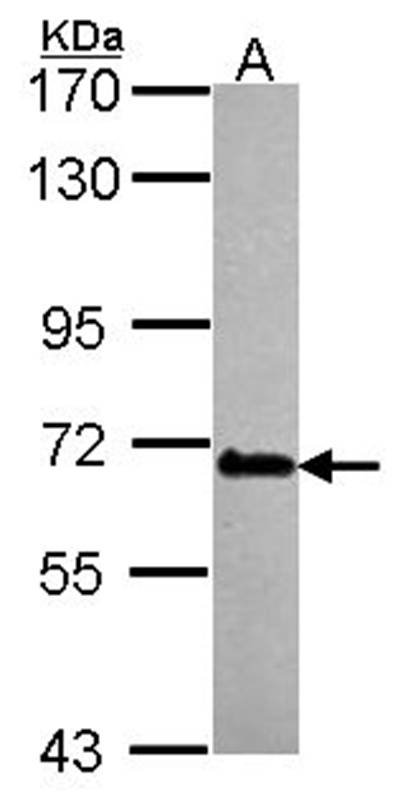 DDX56 antibody