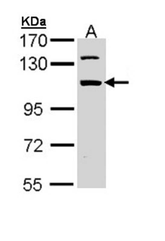 RNA binding motif protein 28 antibody