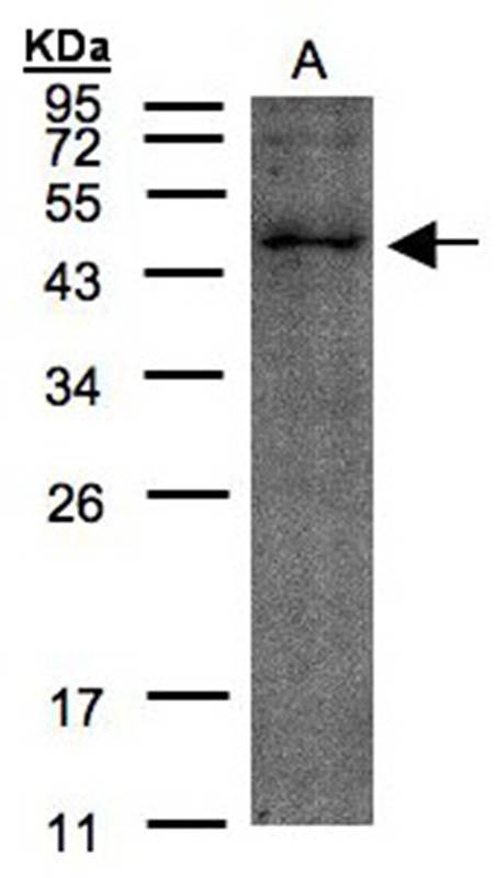 TMLHE antibody