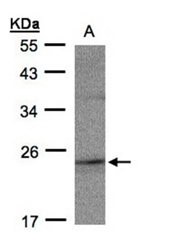 RAP2C, member of RAS oncogene family precursor antibody