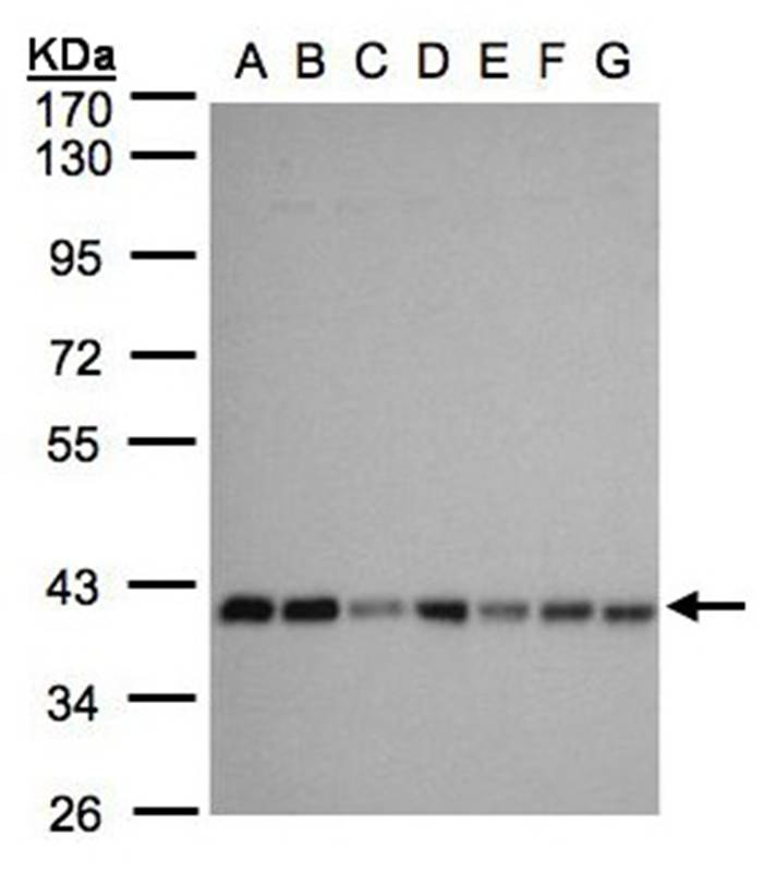 mitochondrial carrier protein MGC4399 antibody