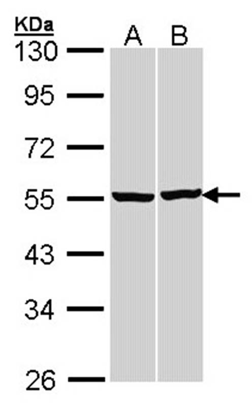 beta Tubulin antibody
