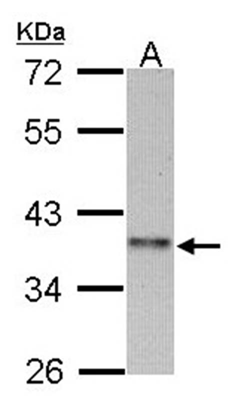 cyclin I family, member 2 antibody