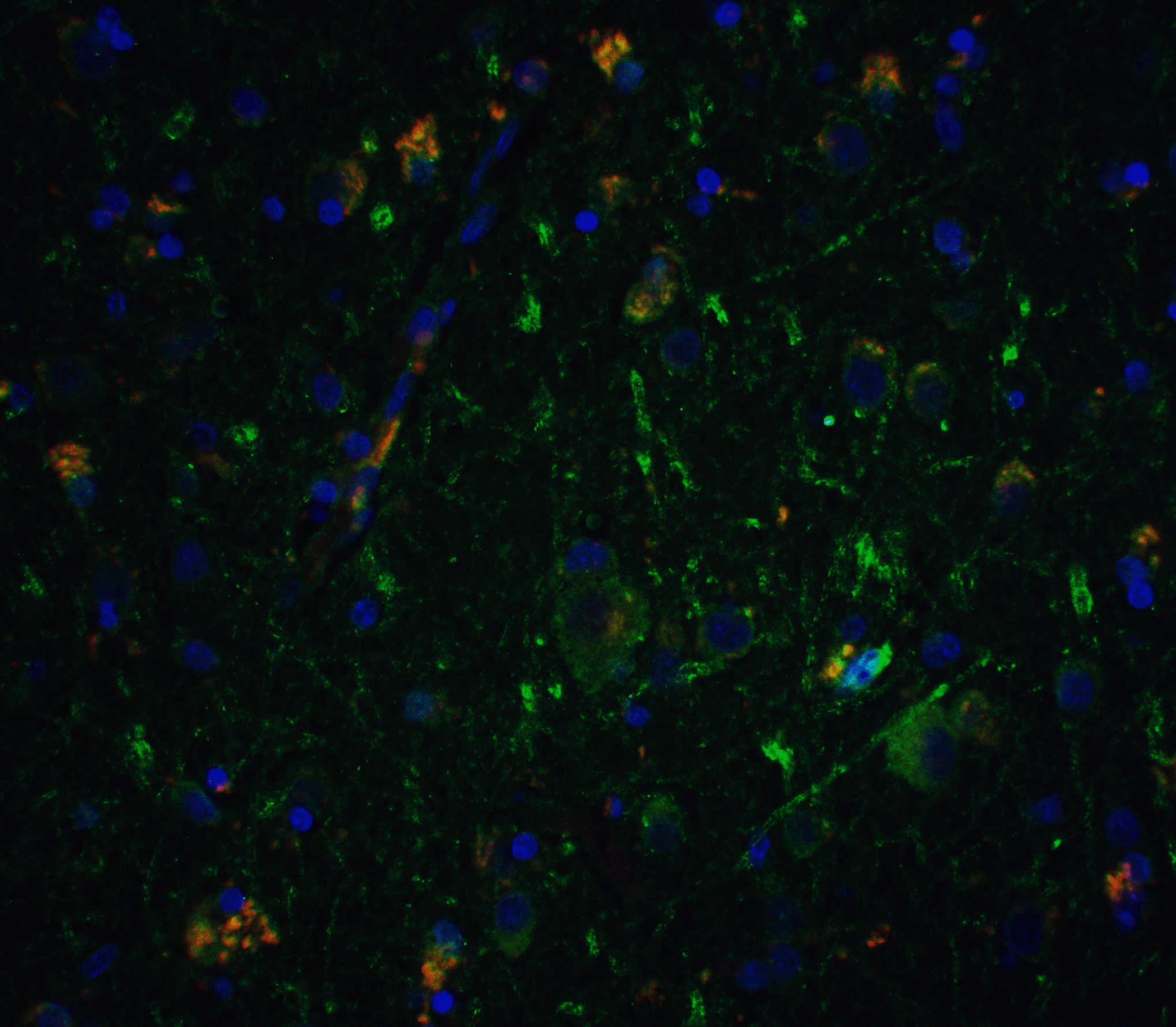 Neurturin Antibody