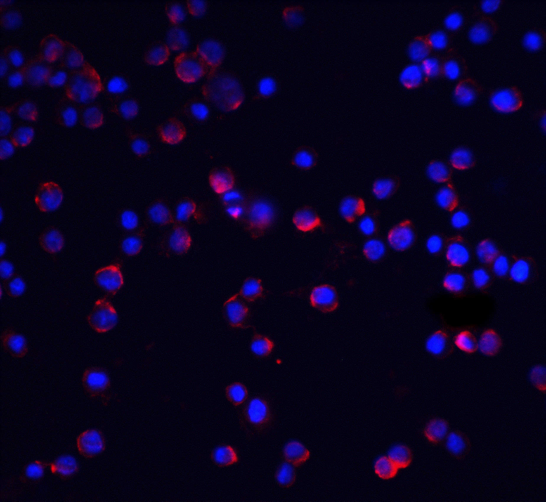ILRAcP Antibody