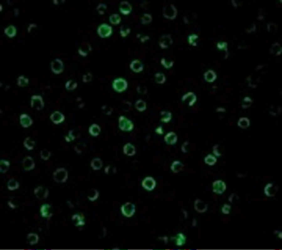 IL-22 Receptor Antibody