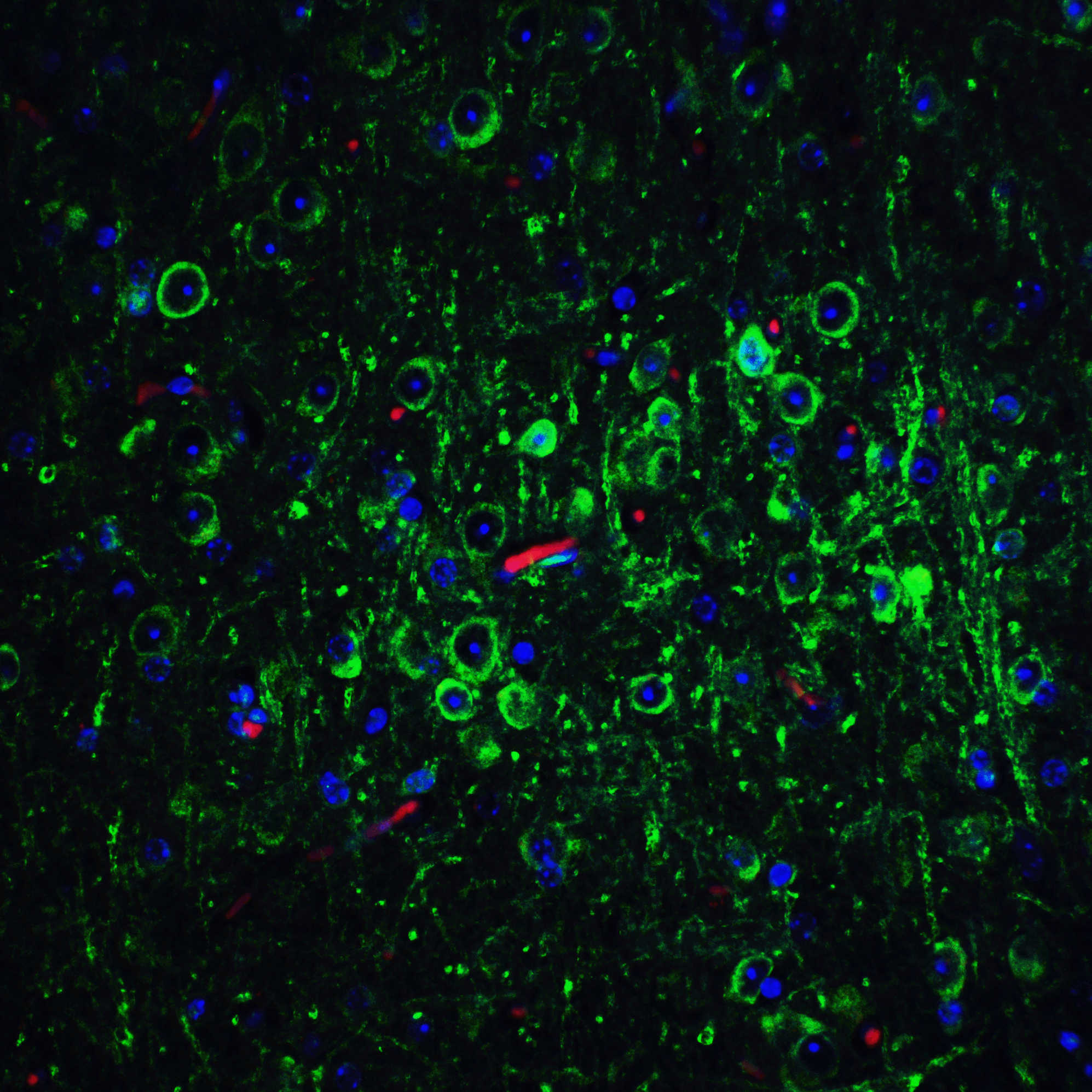 Bcl-2 Antibody