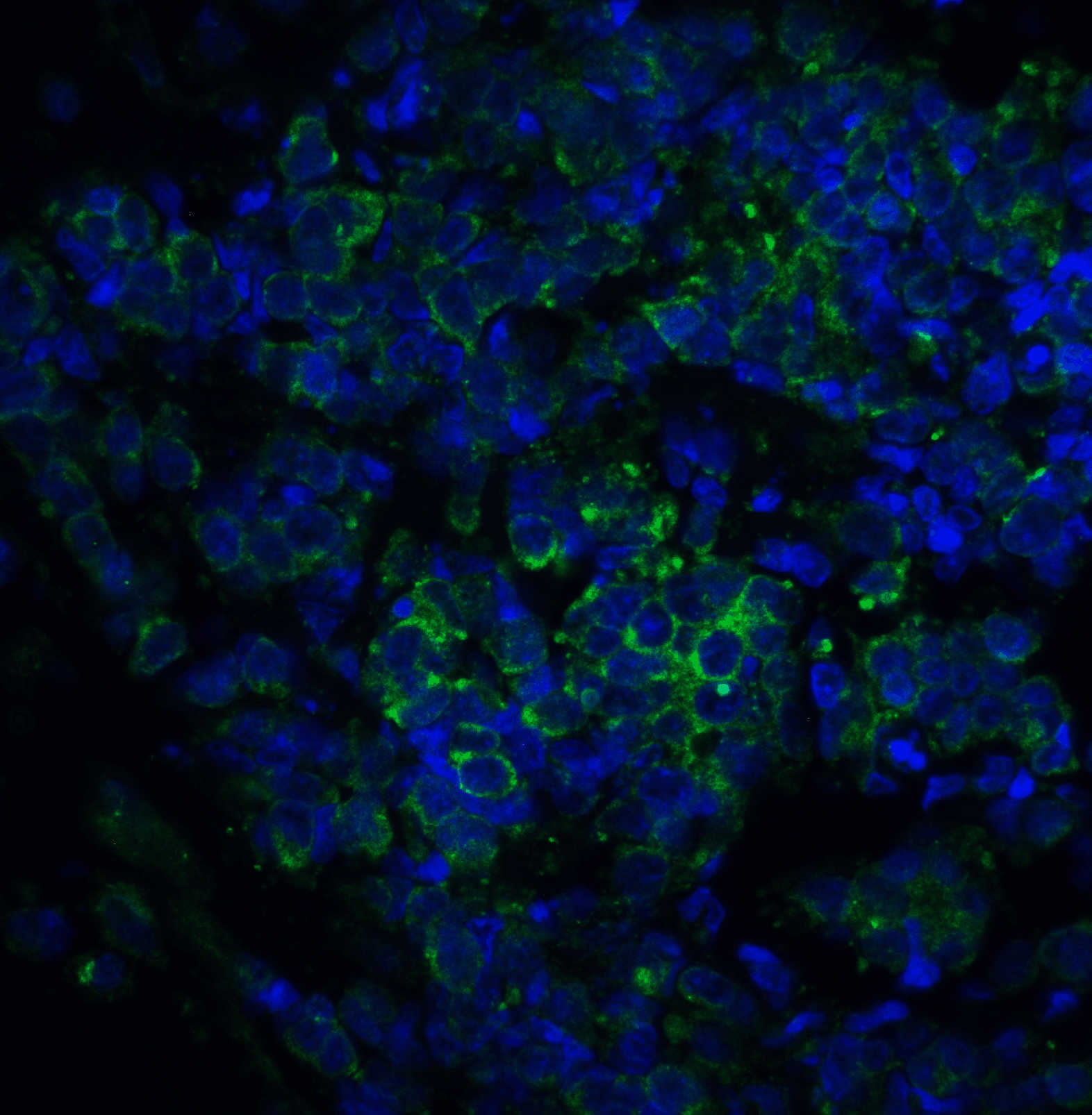ST2 Antibody